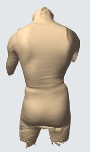 Image of 3D patient torso scan.